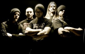 INTESTINAL BAND PHOTO3333333