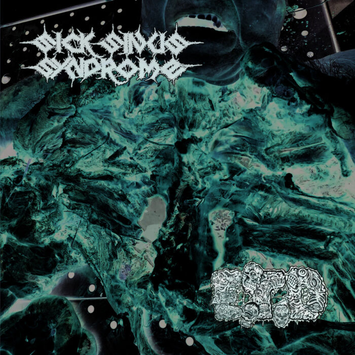 Sick Sinus Syndrome / E.T.D.